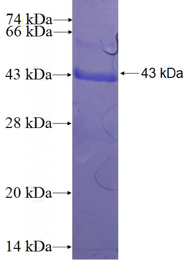 Recombinant Human ISOC1 SDS-PAGE