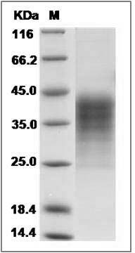 Human LIF Protein (His Tag) SDS-PAGE