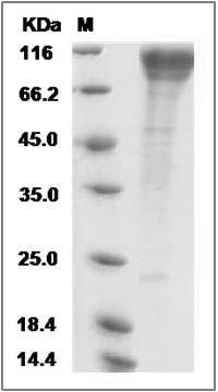 Rat CDH13 / Cadherin-13 / H Cadherin Protein SDS-PAGE