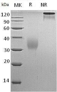 Human AMBP/HCP/ITIL (His tag) recombinant protein