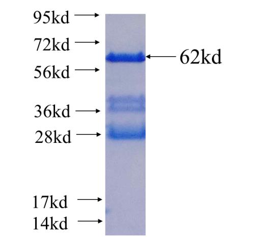 Recombinant human COQ9(Full length) SDS-PAGE