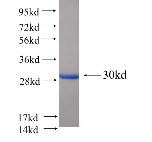 Recombinant human STOML3 SDS-PAGE