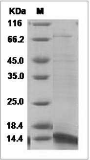 Human IL2 / Interleukin-2 Protein (L35M, L36S, C142A) SDS-PAGE