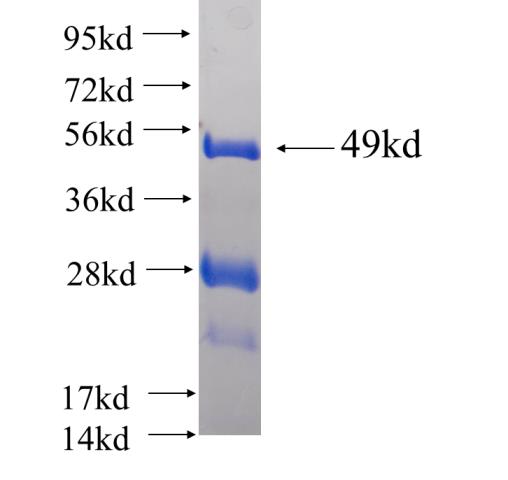 Recombinant human C1orf83 SDS-PAGE