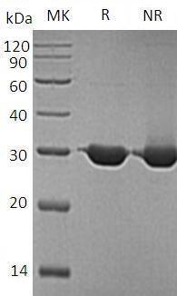 Human BDH2/DHRS6/SDR15C1/UNQ6308 (His tag) recombinant protein