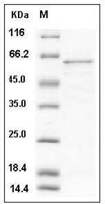 Human GOLM1 / GP73 Protein (His Tag) SDS-PAGE