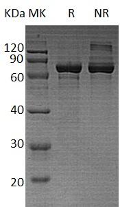 Human IMPDH2/IMPD2 (His tag) recombinant protein