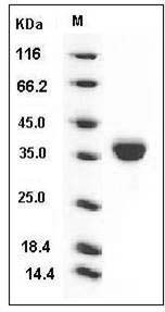 Mouse EpCAM / TROP-1 / TACSTD1 Protein (His Tag) SDS-PAGE