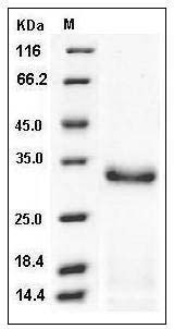 Mouse Trypsin 2 / PRSS2 Protein (His Tag) SDS-PAGE