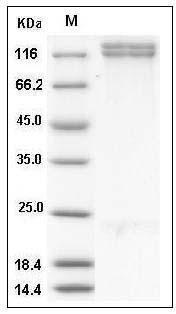 Human ITGA8 & ITGB1 Heterodimer Protein SDS-PAGE
