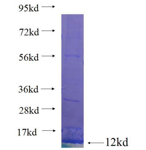 Recombinant human C1orf170 SDS-PAGE