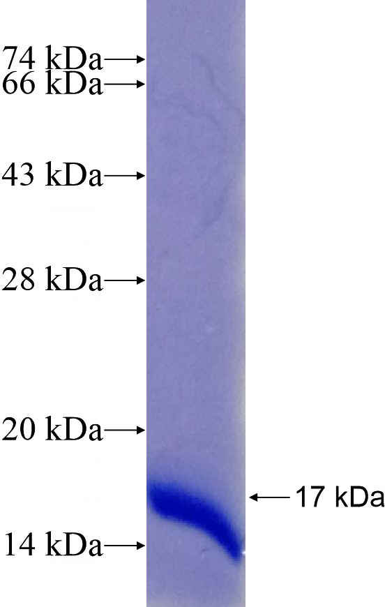 Recombinant Human SNX27 SDS-PAGE