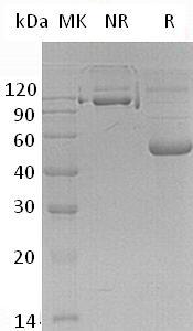 Human CD70/CD27L/CD27LG/TNFSF7 (Fc tag) recombinant protein