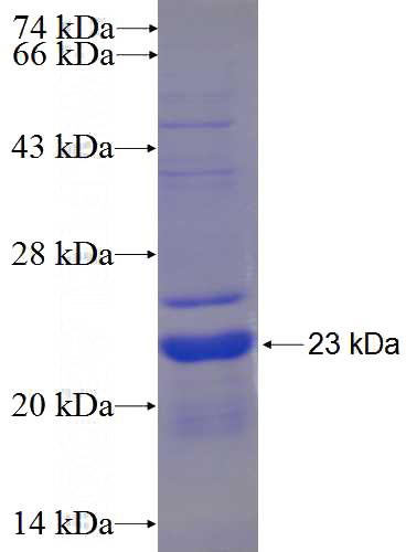 Recombinant Human C9orf25 SDS-PAGE