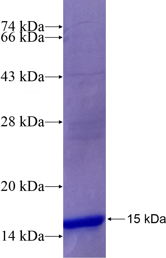 Recombinant Human ARPC1B SDS-PAGE