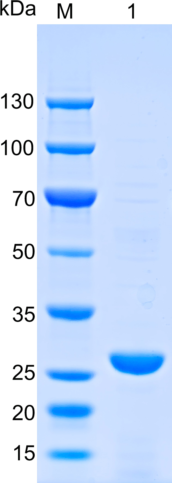Human ALKBH5 Recombinant protein (6*His tag)