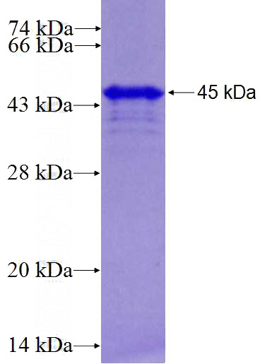 Recombinant Human KMT2D SDS-PAGE