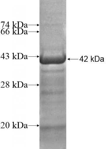 Recombinant Human RALY SDS-PAGE