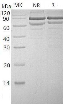 Human SEMA3A/SEMAD (His tag) recombinant protein