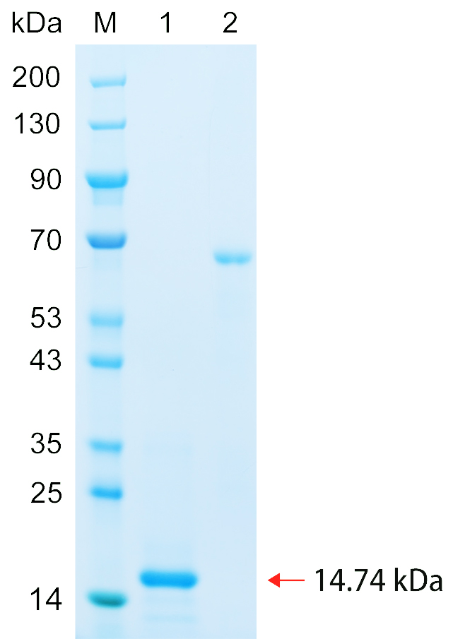 Recombinant IKZF2 protein (His tag) SDS-PAGE