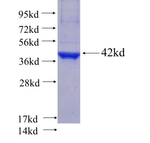 Recombinant human SUCLA2 SDS-PAGE