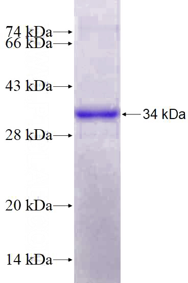 Recombinant Human OLFML2A SDS-PAGE