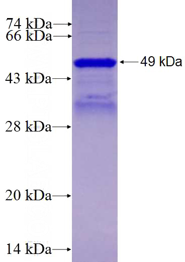 Recombinant Human CNOT2 SDS-PAGE