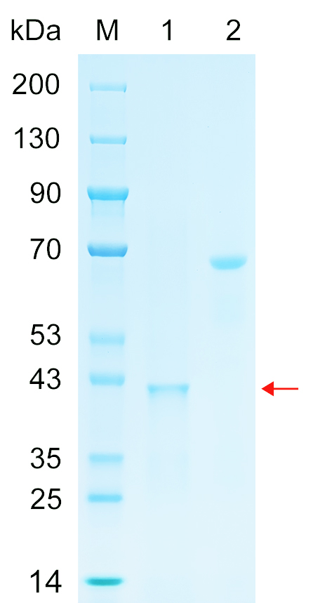 Recombinant QTGAL protein (His tag) SDS-PAGE