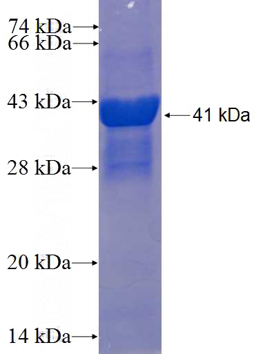 Recombinant Human C10orf97 SDS-PAGE