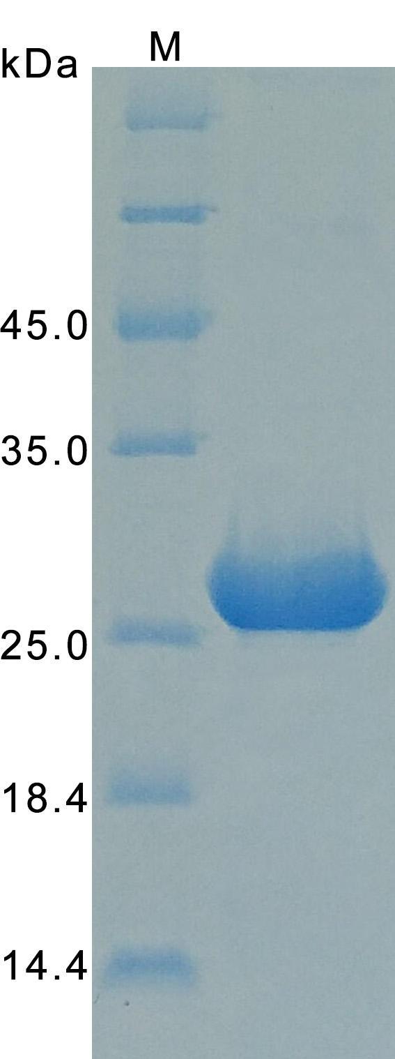 Human PRL recombinant protein