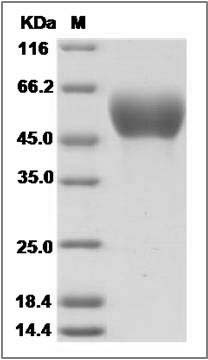 Influenza A H5N1 (A/common magpie/Hong Kong/5052/2007) Hemagglutinin Protein (HA1 Subunit) (His Tag) SDS-PAGE