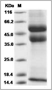 Rat Latent TGF-beta 1 / TGFB1 Protein (His Tag) SDS-PAGE