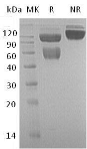 Mouse Tnfrsf10b/Dr5/Killer (Fc tag) recombinant protein