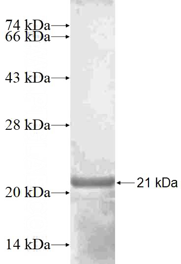 Recombinant Human p504S,AMACR SDS-PAGE