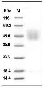 Human CD34 Protein (His Tag) SDS-PAGE