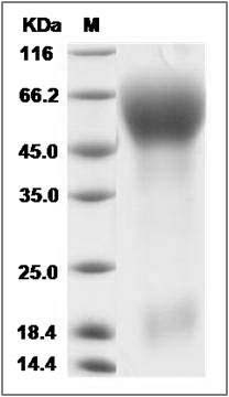 Rat CD133 / PROM1 / Prominin 1 Protein (His Tag) SDS-PAGE
