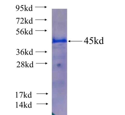 Recombinant human SNX9 SDS-PAGE