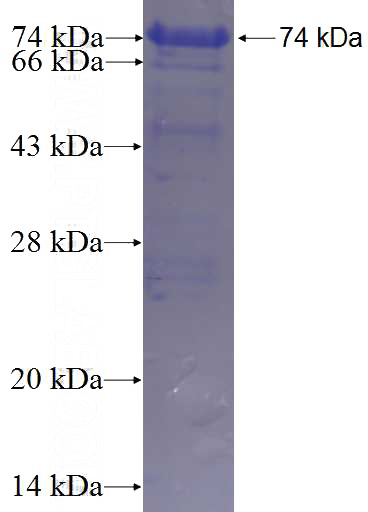 Recombinant Human CCDC66 SDS-PAGE