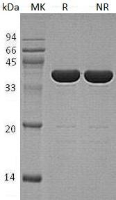 Human GABARAP/hCG_1987397 (GST tag) recombinant protein