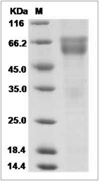 Human HVEM / TNFRSF14 Protein (His & Fc Tag) SDS-PAGE