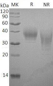 Rabbit CD80 (His tag) recombinant protein