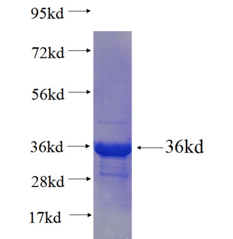 Recombinant human LSM8(Full length) SDS-PAGE