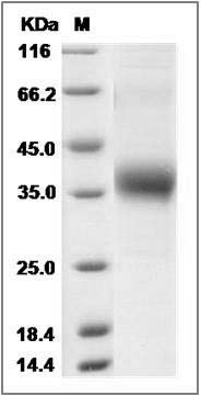 Cynomolgus OLR1 / LOX1 Protein (His Tag) SDS-PAGE
