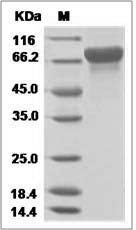 Influenza A H3N2 (A/Hanoi/EL134/2008) Hemagglutinin / HA Protein (His Tag)