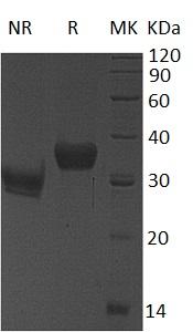 Human KLK8/NRPN/PRSS19/TADG14 (His tag) recombinant protein
