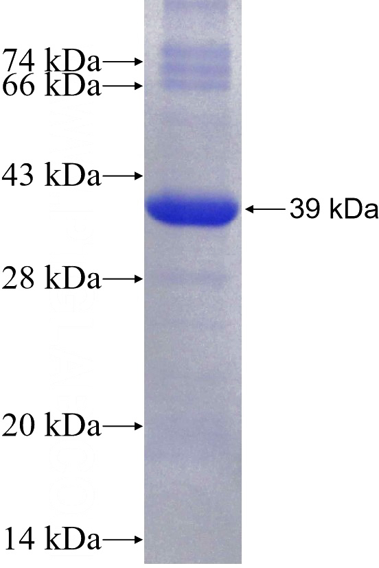 Human TOE1 Recombinant protein (6*His tag)