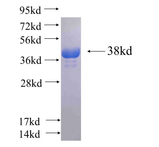 Recombinant human INPPL1 SDS-PAGE