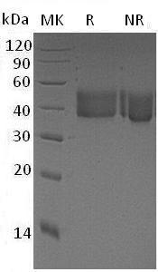 Mouse Cfd/Adn/Df (His tag) recombinant protein