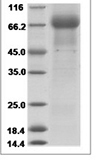 Human IL-22BP/IL-22RA2 Protein 15325