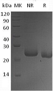 Human CCDC134 (His tag) recombinant protein